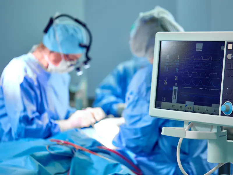 Outcomes with controlled moderate hypothermic preservation vs static cold storage in heart transplantation